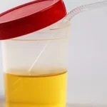 Tiktoker recomenda usar urina para curar a visão. O que a ciência diz disso?
