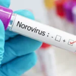 6 coisas que você deve saber sobre o norovírus