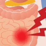 Gases na barriga – Principais causas, tratamento e como evitar
