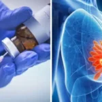Vacina experimental contra o câncer de mama triplo-negativo apresenta resultados promissores